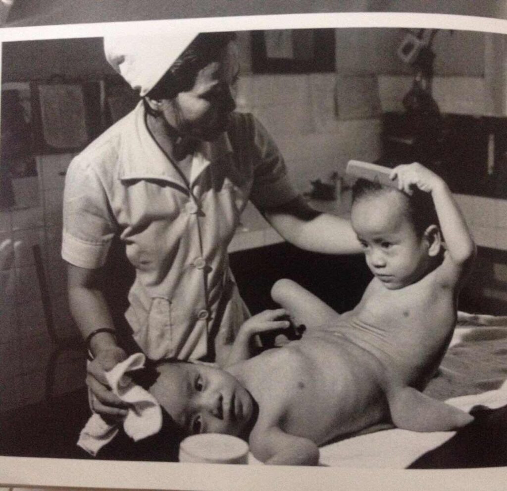 ベトちゃんドクちゃん